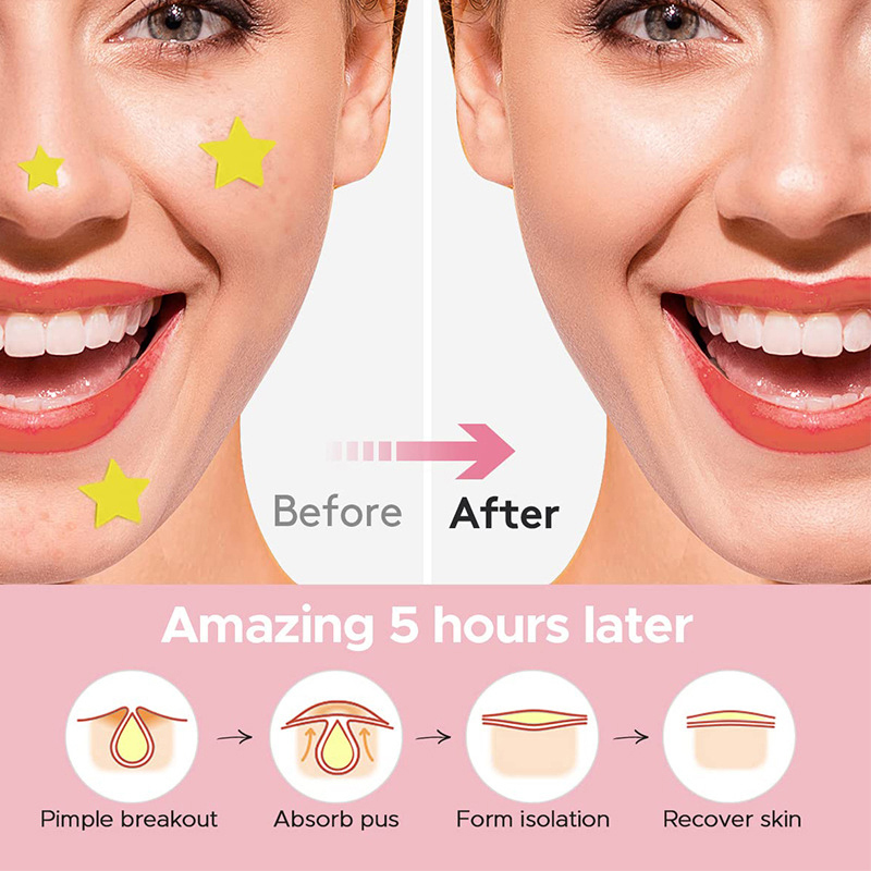 600Pcs/set Star Pimple Patch A - đánh giá và giá Beauty Makeup Tool