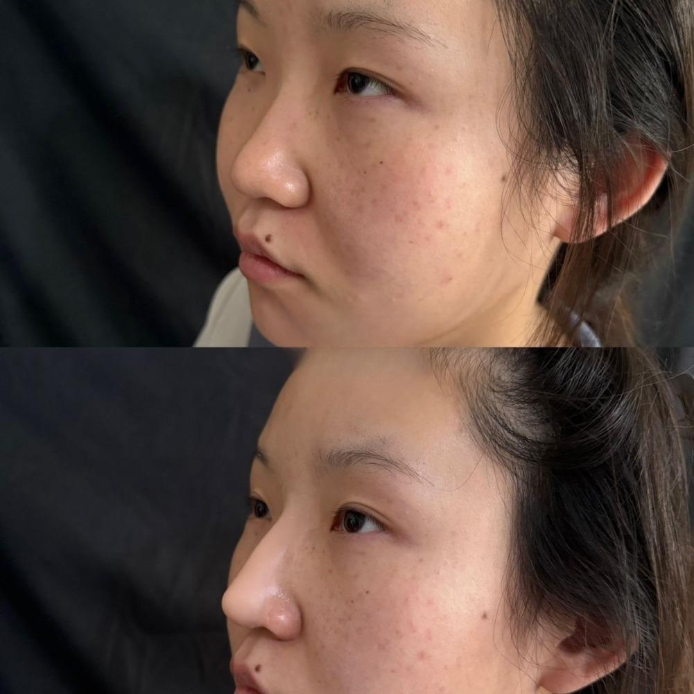  Silicone Fake Nose Kit Soft  - đánh giá và giá J Beauty Makeup